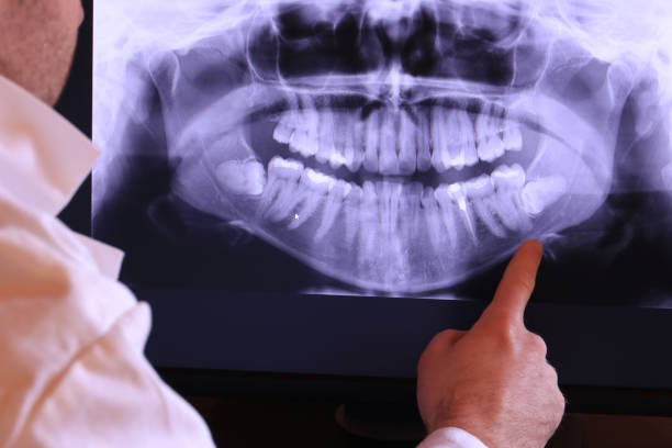 Best Emergency Broken Tooth Repair in Rice, TX